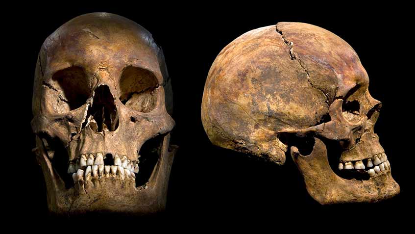 King Richard III's skull