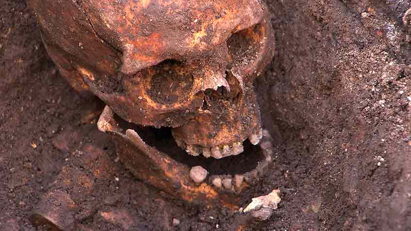 Richard III's skull