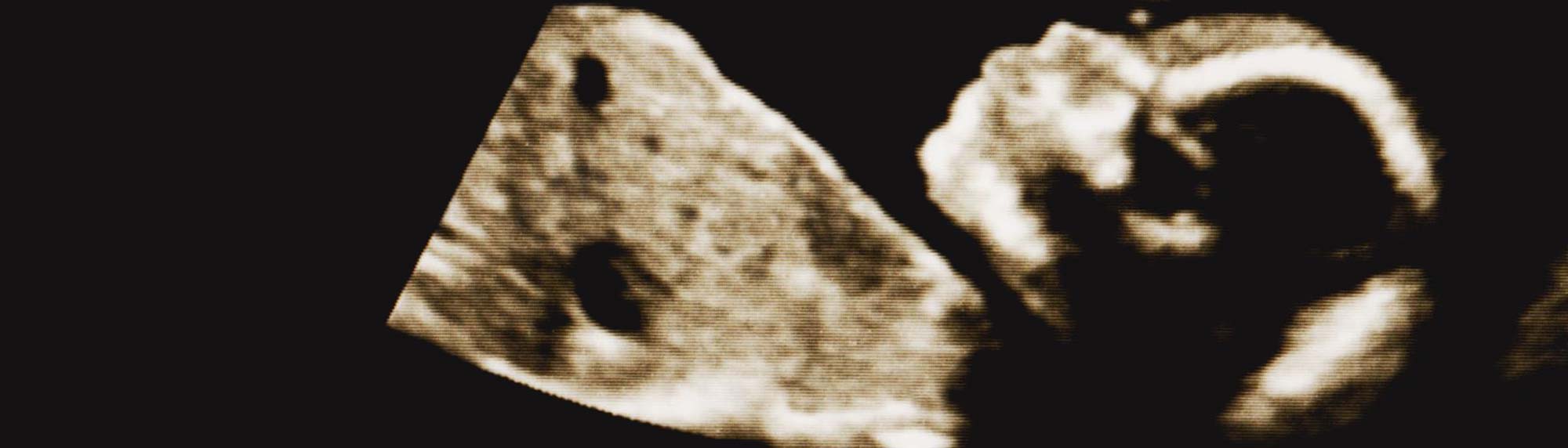 Scan of a baby in the womb