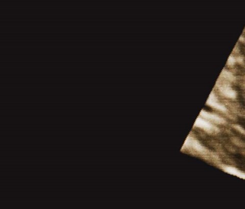 Scan of a baby in the womb